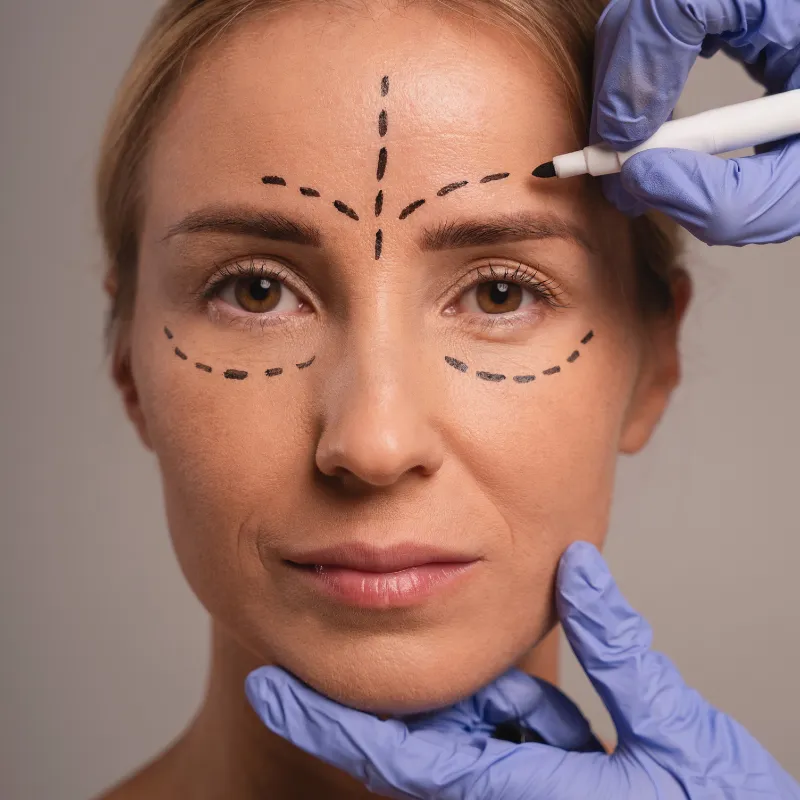 lifting facial
